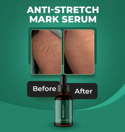 Markaway Stretch Mark Serum | Herbal Hydration, Toning & Dark Spot Corrector – 30ml